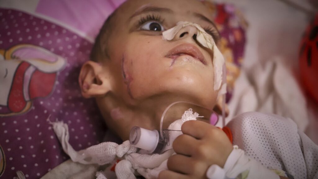 A boy in Gaza with brain damage fights for his life amid blockade A boy in Gaza with brain damage fights for his life amid blockade