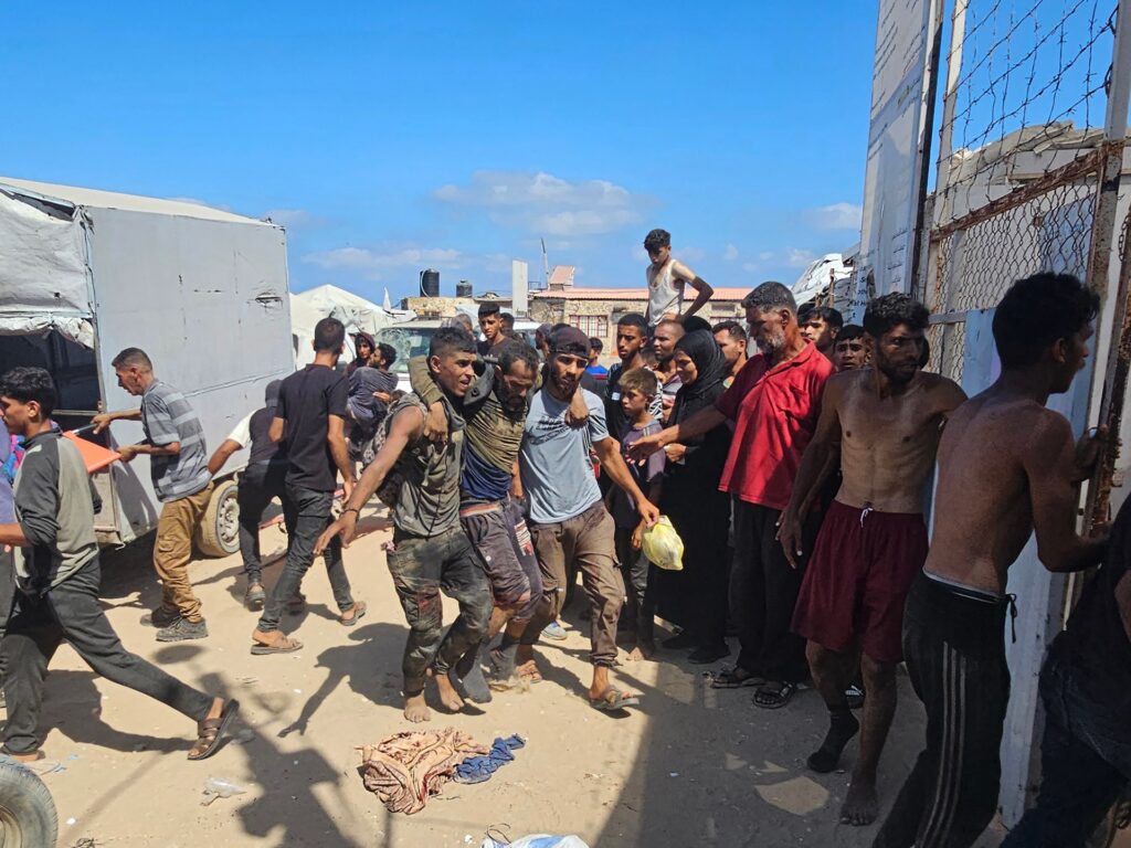 Dozens killed by Israel at aid site in Gaza, children dying of malnutrition Dozens killed by Israel at aid site in Gaza, children dying of malnutrition