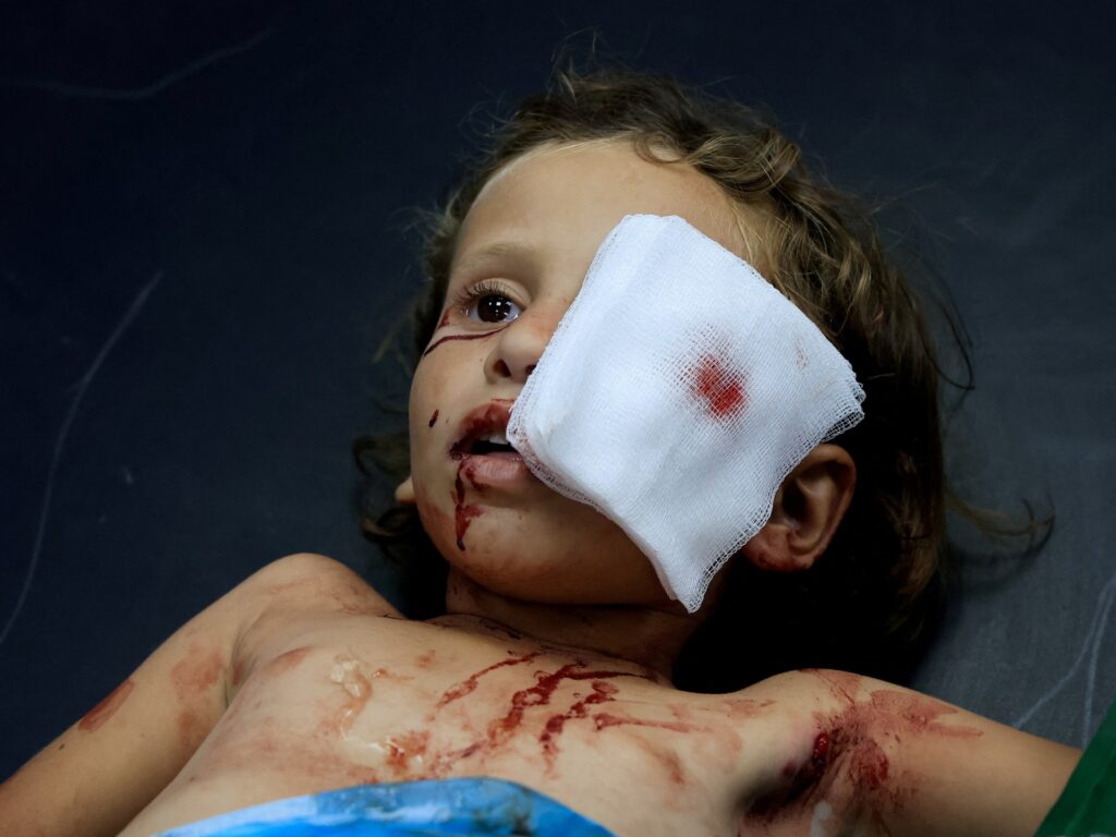 I was training to heal eyes in Gaza. Then everything went dark I was training to heal eyes in Gaza. Then everything went dark