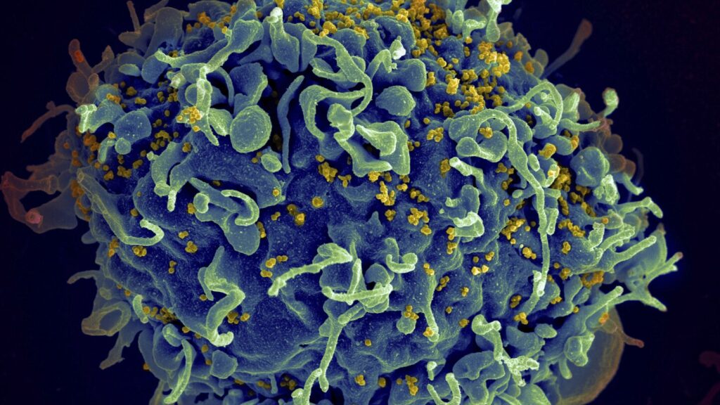 UN says if US funding for HIV programs is not replaced, millions more will die by 2029 UN says if US funding for HIV programs is not replaced, millions more will die by 2029