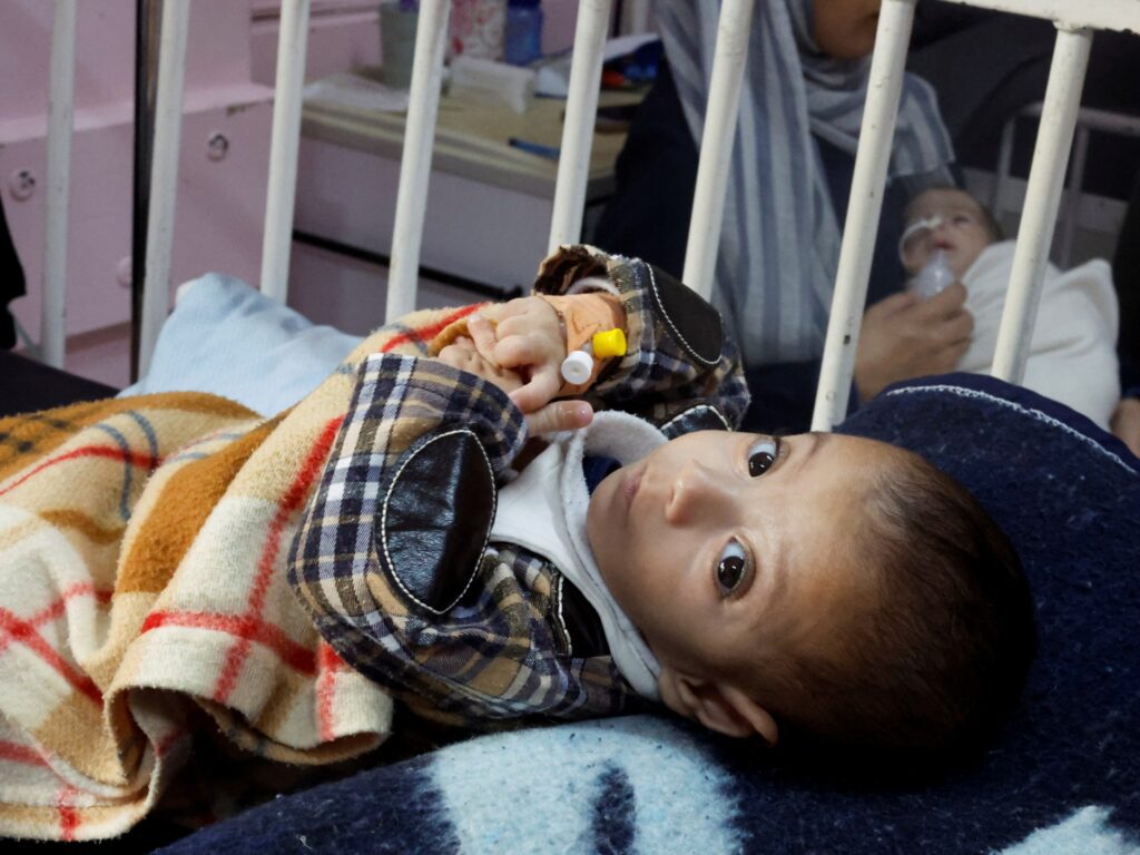 UNRWA sounds alarm as 1 in 10 children in Gaza malnourished UNRWA sounds alarm as 1 in 10 children in Gaza malnourished