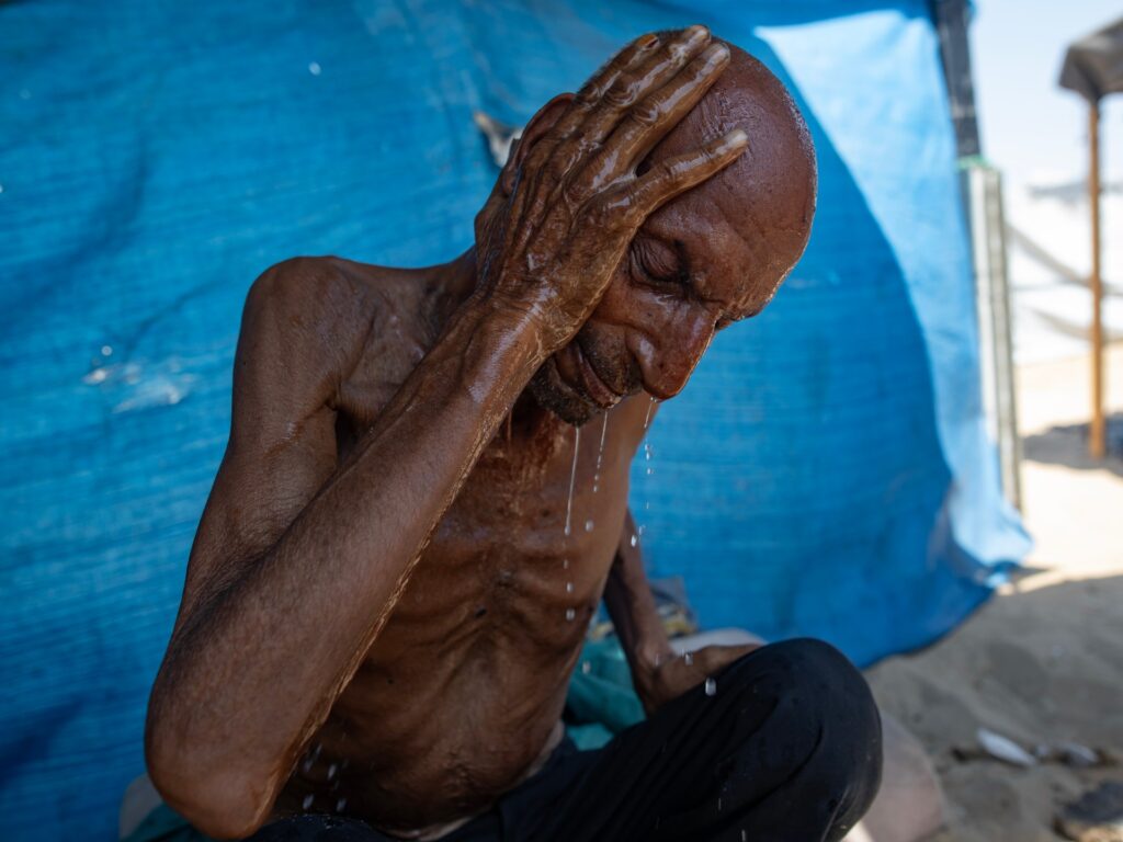 What ‘starvation’ really means, for the human body and for Gaza What ‘starvation’ really means, for the human body and for Gaza