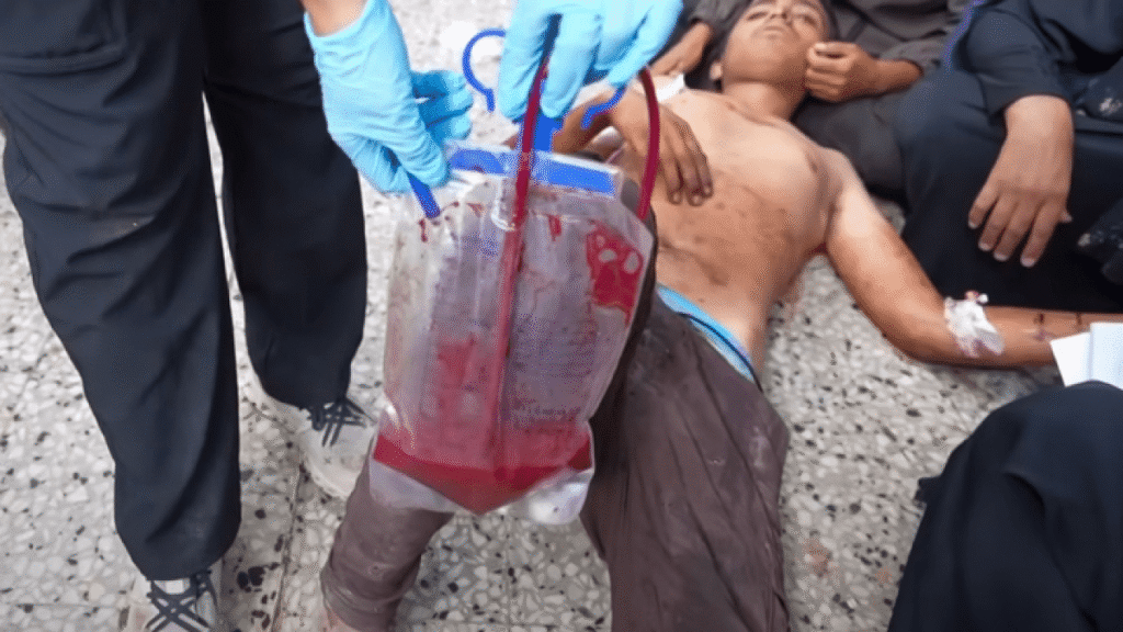 Dire blood shortage in Gaza as deaths from Israeli attacks, starvation grow