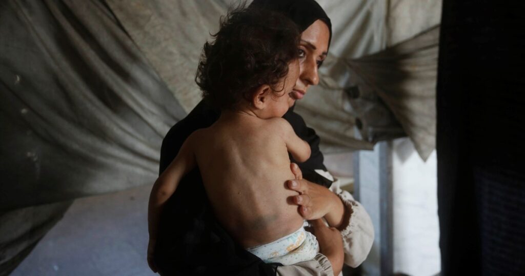 Israel’s starvation denial is an Orwellian farce
