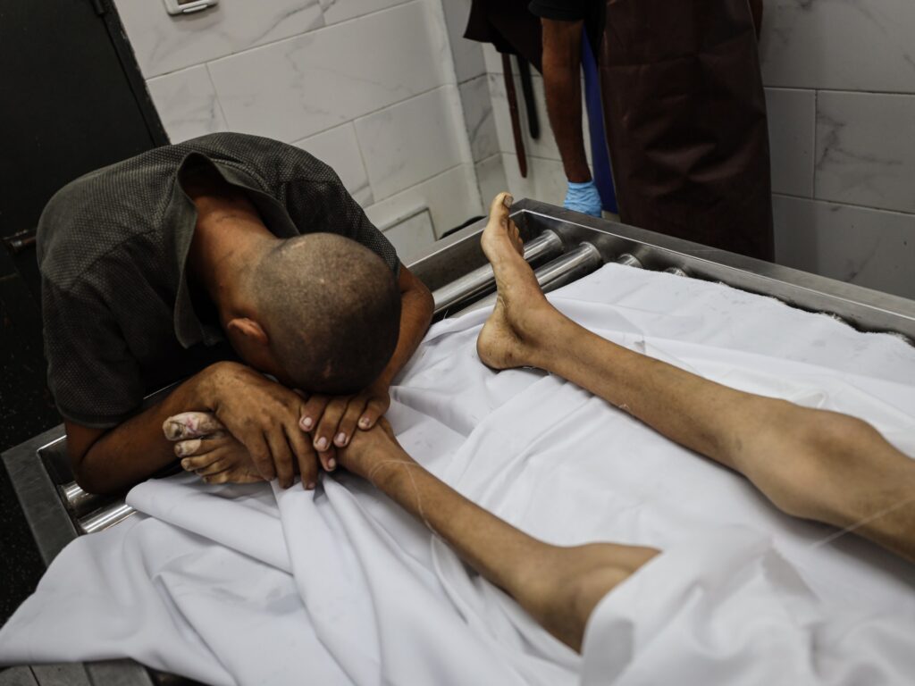 Palestinian boy, 17, dies of Israel-induced starvation in Gaza Palestinian boy, 17, dies of Israel-induced starvation in Gaza