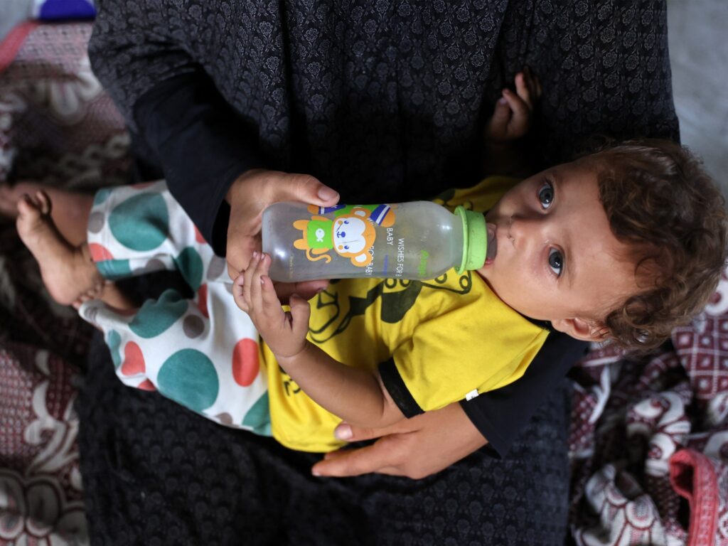 UN says every child under five in Gaza at risk of malnourishment UN says every child under five in Gaza at risk of malnourishment