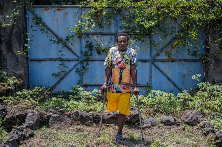 Injured man in Goma