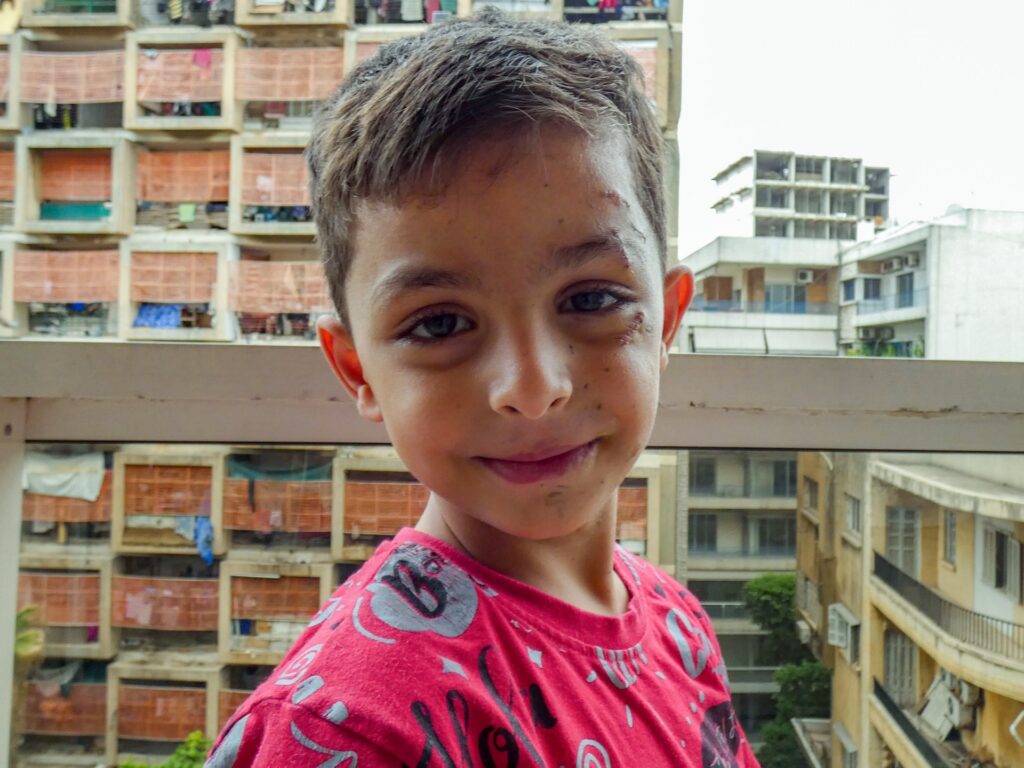 Orphaned by Israel, two child amputees find each other in Lebanon Orphaned by Israel, two child amputees find each other in Lebanon