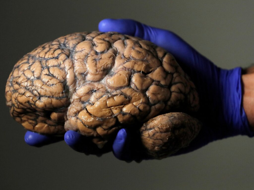 Does adolescence last until 32? Scientists unlock brain’s five eras Does adolescence last until 32? Scientists unlock brain’s five eras