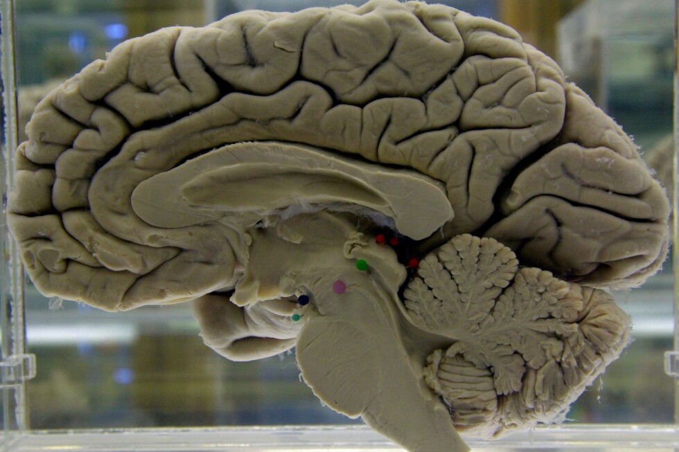 Challenging your brain helps keep it healthy. Here’s how to do it Challenging your brain helps keep it healthy. Here's how to do it