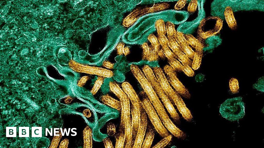 New outbreak of Ebola kills 65 in eastern DR CongoAfrica's top health agency says around 246 cases have been reported.1 hr agoAfrica New outbreak of Ebola kills 65 in eastern DR CongoAfrica's top health agency says around 246 cases have been reported.1 hr agoAfrica