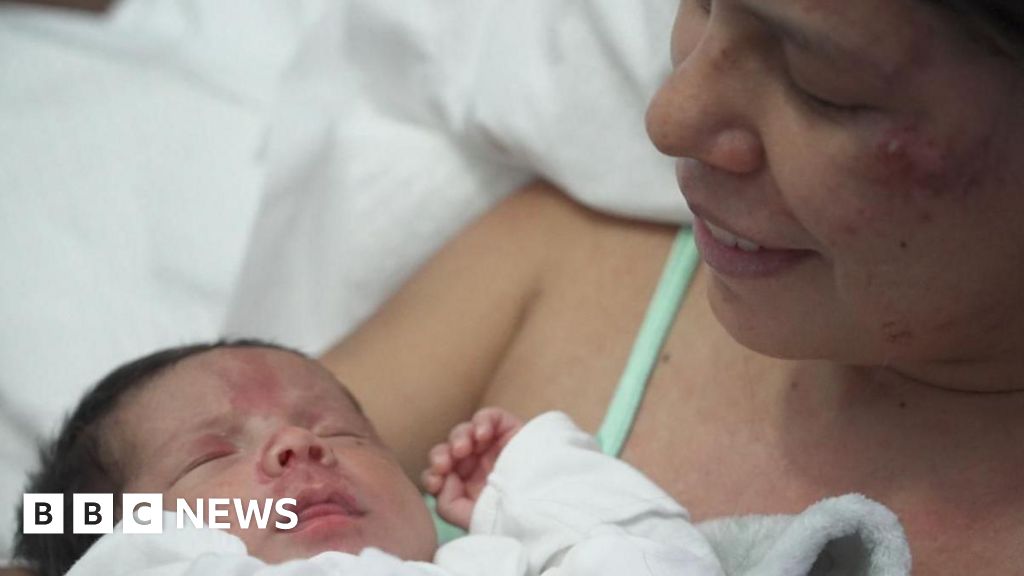 Mum of newborn rescued from Venezuela rubble says baby motivated her to stay aliveThe "miracle" rescue of 18-day-old baby Juan David is a symbol of hope in Venezuela after the devastating earthquakes.30 mins agoLatin America Mum of newborn rescued from Venezuela rubble says baby motivated her to stay aliveThe "miracle" rescue of 18-day-old baby Juan David is a symbol of hope in Venezuela after the devastating earthquakes.30 mins agoLatin America