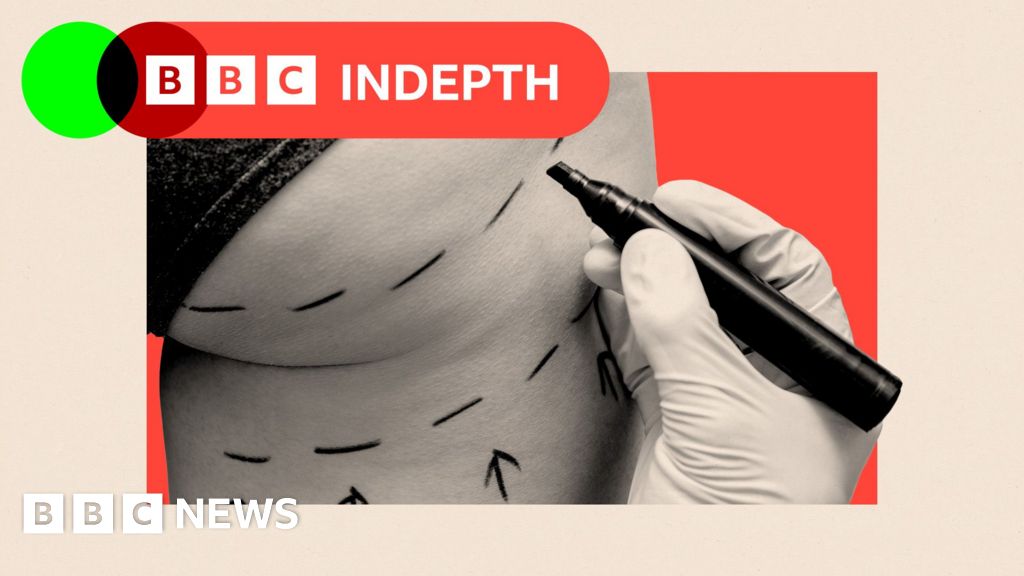 The dark side of the Brazillian butt lift boomThe aesthetics industry is worth billions but campaigners say there have been numerous cases of serious harm.52 mins agoBBC InDepth The dark side of the Brazillian butt lift boomThe aesthetics industry is worth billions but campaigners say there have been numerous cases of serious harm.52 mins agoBBC InDepth