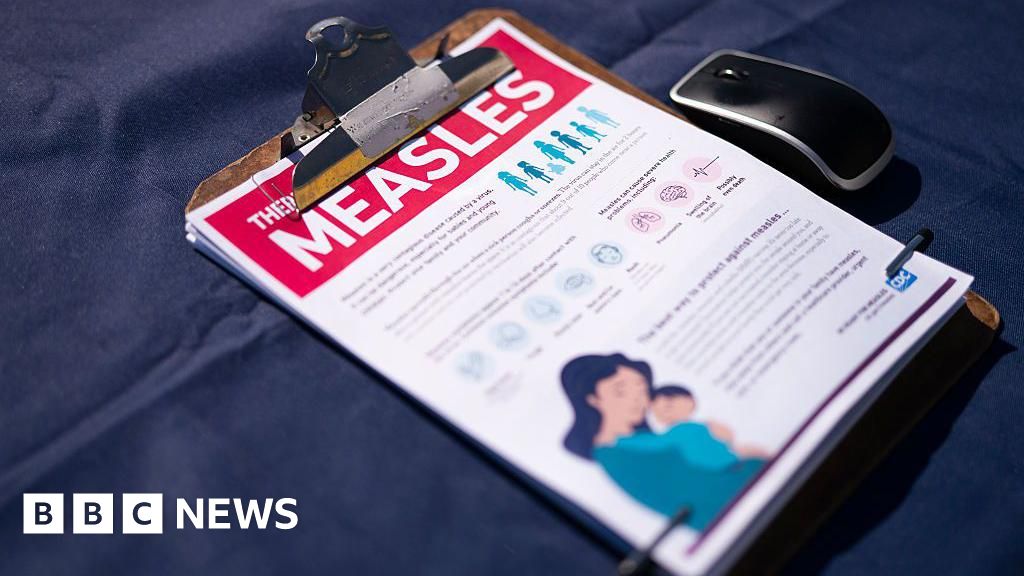 US measles cases reach 35-year highThere have been 2,318 confirmed cases of the virus, higher than last year's total with five months to go.2 hrs agoHealth US measles cases reach 35-year highThere have been 2,318 confirmed cases of the virus, higher than last year's total with five months to go.2 hrs agoHealth