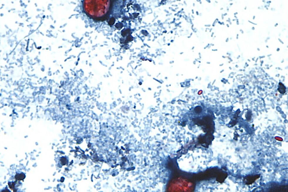 Outbreak of diarrhea-causing parasite grows to more than 1,000 cases Outbreak of diarrhea-causing parasite grows to more than 1,000 cases