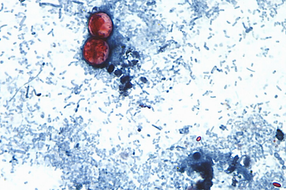 US health officials are investigating a new outbreak of a diarrhea-causing parasite US health officials are investigating a new outbreak of a diarrhea-causing parasite