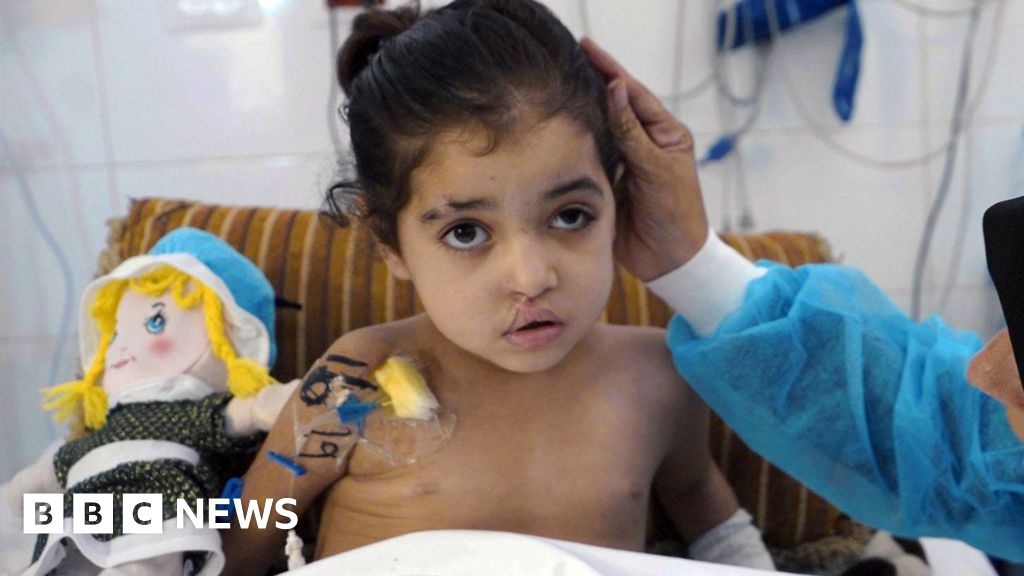 Girl has multiple surgeries to control infections after strike in GazaWitnesses say Raseel's tent was hit by an Israeli helicopter strike. Israel’s military says it has no record of the attack.59 mins agoMiddle East Girl has multiple surgeries to control infections after strike in GazaWitnesses say Raseel's tent was hit by an Israeli helicopter strike. Israel’s military says it has no record of the attack.59 mins agoMiddle East