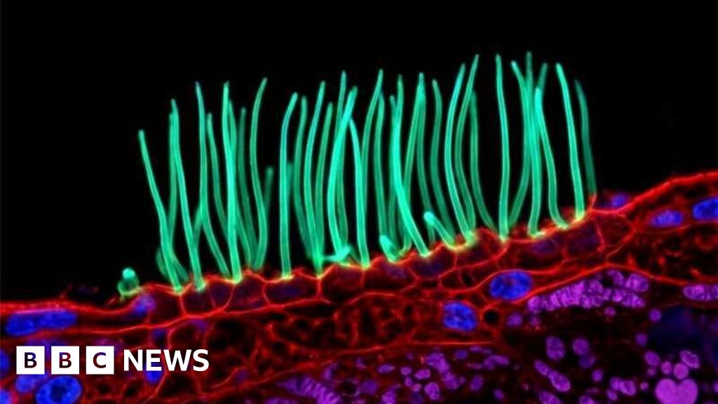 Tiny image sparks big backlash in Nikon photo contestDr Ning Xu denies he broke the rules of Nikon's annual Small World In Motion contest.11 hrs agoTechnology Tiny image sparks big backlash in Nikon photo contestDr Ning Xu denies he broke the rules of Nikon's annual Small World In Motion contest.11 hrs agoTechnology