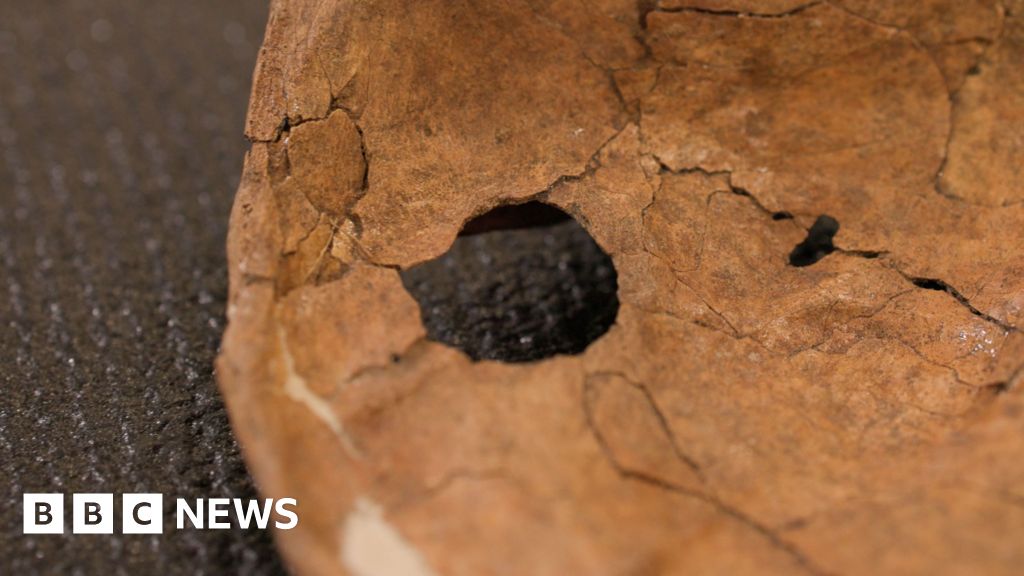 Was Neanderthal life violent? This wound suggests lethal fighting was more commonA 75,000-year-old Neanderthal spear wound may be evidence violence shaped human life far earlier than thought.3 hrs agoScience & Environment Was Neanderthal life violent? This wound suggests lethal fighting was more commonA 75,000-year-old Neanderthal spear wound may be evidence violence shaped human life far earlier than thought.3 hrs agoScience & Environment